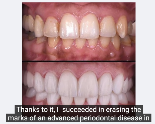 prodentim review